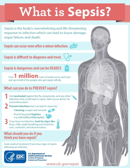 ACTSI Investigators Contribute To Updated Sepsis Definition Georgia 