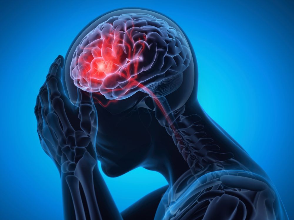 illustration of brain injury