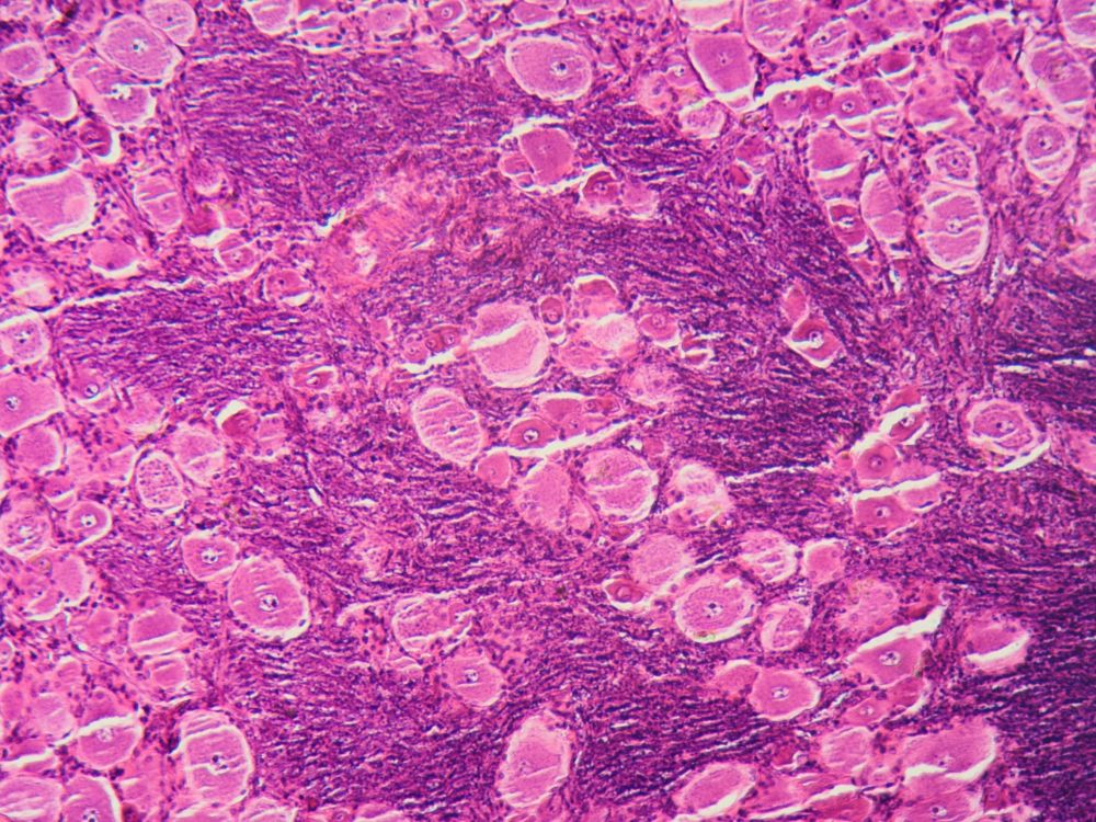 human cells