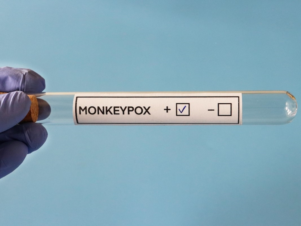 test tube labeled monkeypox