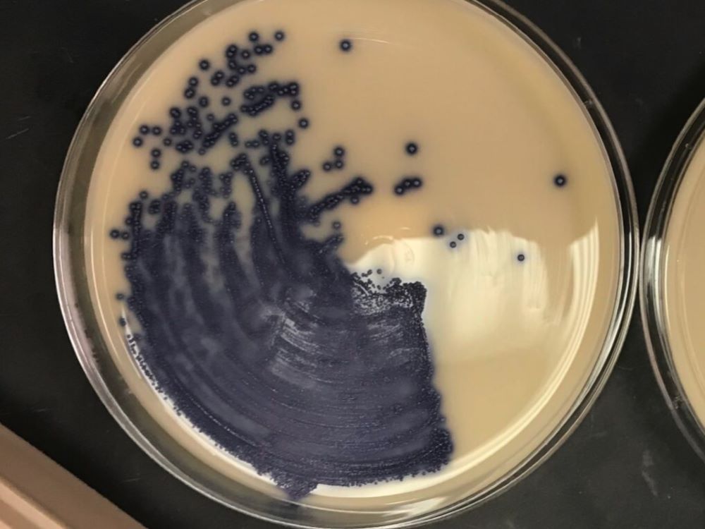 Microbes in a dish