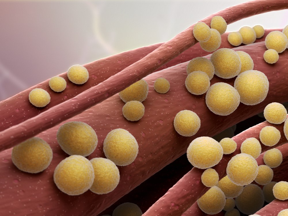 Staph bacteria on tissue
